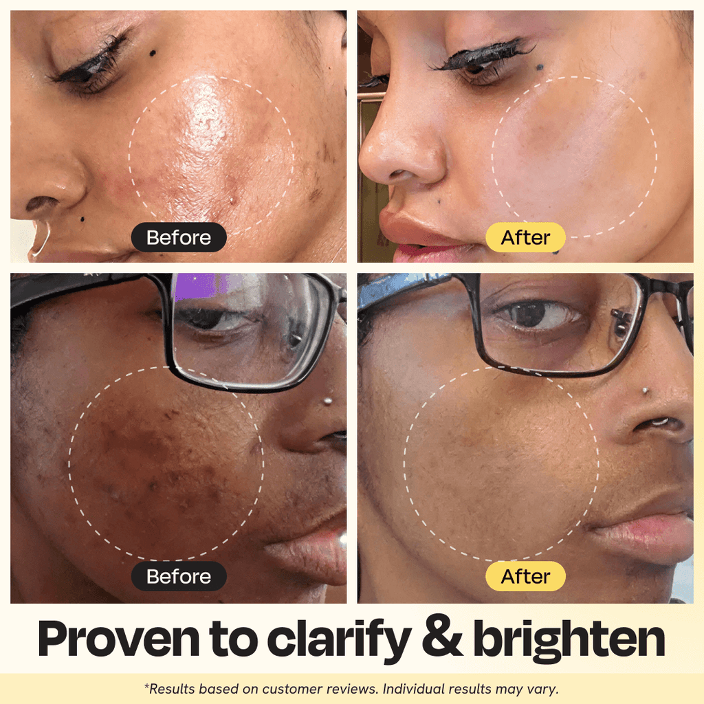 Vitamin C Clay Mask (Copy)