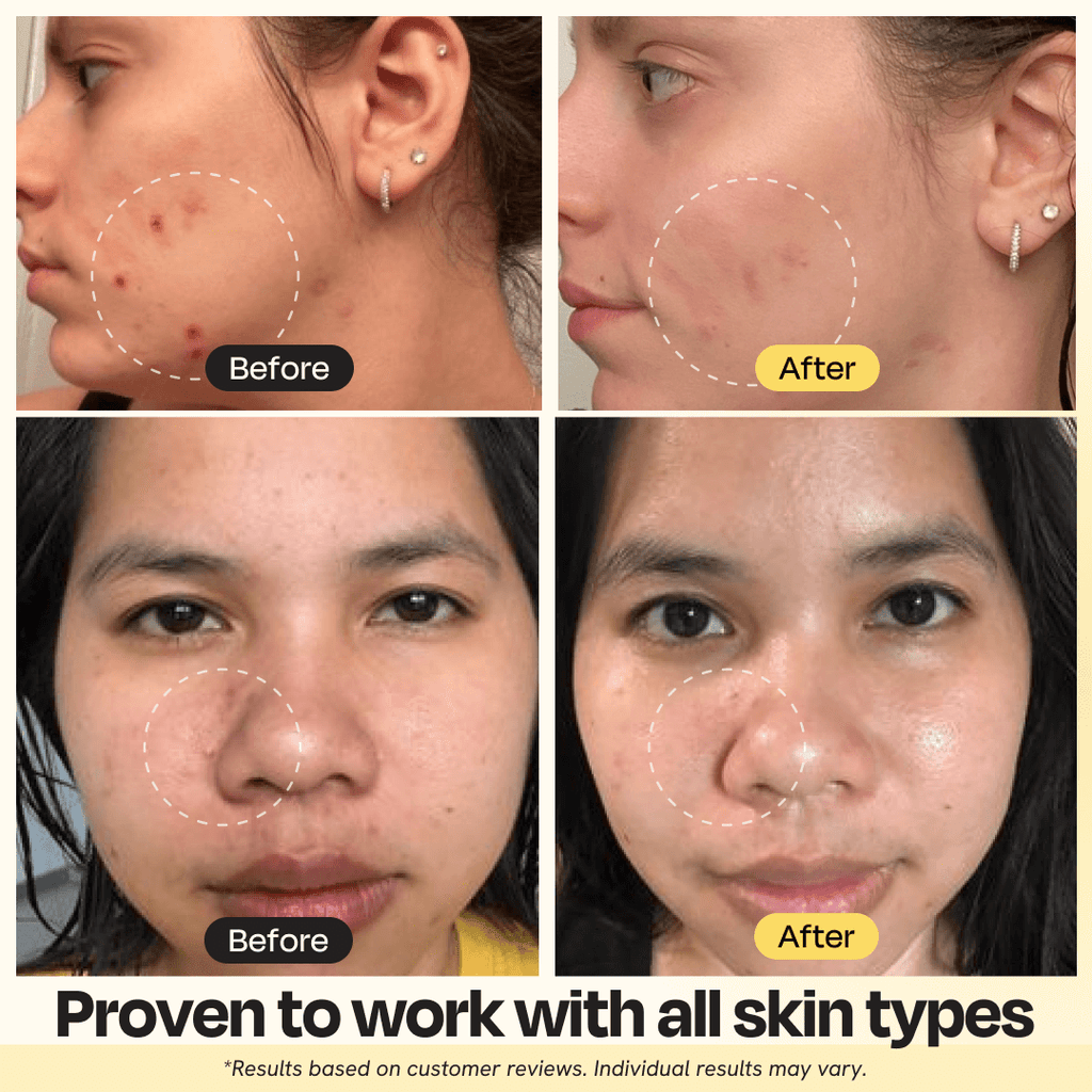 Vitamin C Clay Mask (Copy)